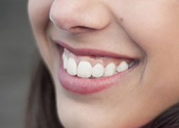 Closeup of a teenager smiling